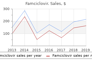 buy famciclovir 250 mg free shipping