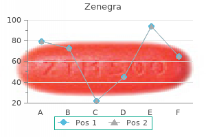 purchase zenegra 100 mg on line