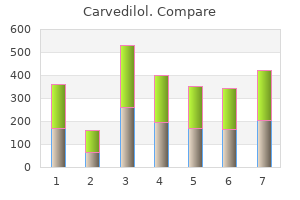 generic carvedilol 25 mg without prescription