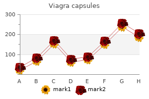 order genuine viagra capsules on line