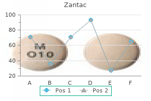 quality zantac 150 mg