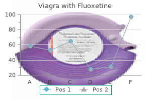 buy 100/60 mg viagra with fluoxetine overnight delivery