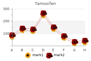 order tamoxifen 20 mg amex
